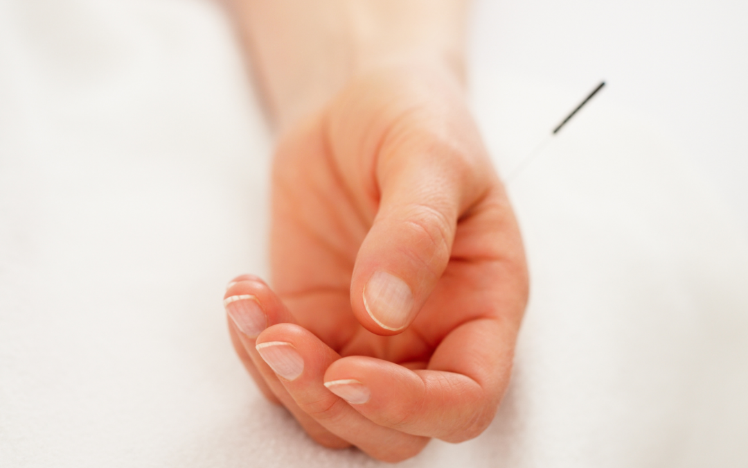 Akupunktur fertilitet