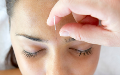 Har du overvejet at bruge akupunktur til at øge din fertilitet?
